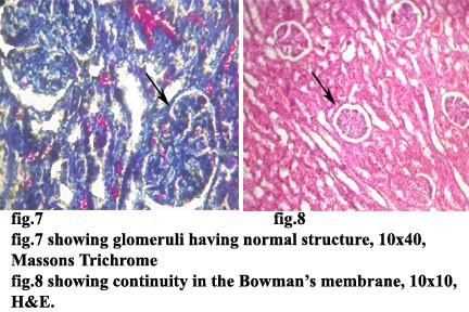 By the end of 6wks, hyaline cast disappeared and by the end of 9wks, 80% of glomeruli have regained their normal structureand enclosed ny continuous bowman s capsule(fig.