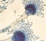 fumigatus Resistance Matched Isolates (N = 396) 5.% 3.76%.00% Itraconazole Voriconazole Posaconazole Wiederhold et al. Advances Against Aspergillosis 0.