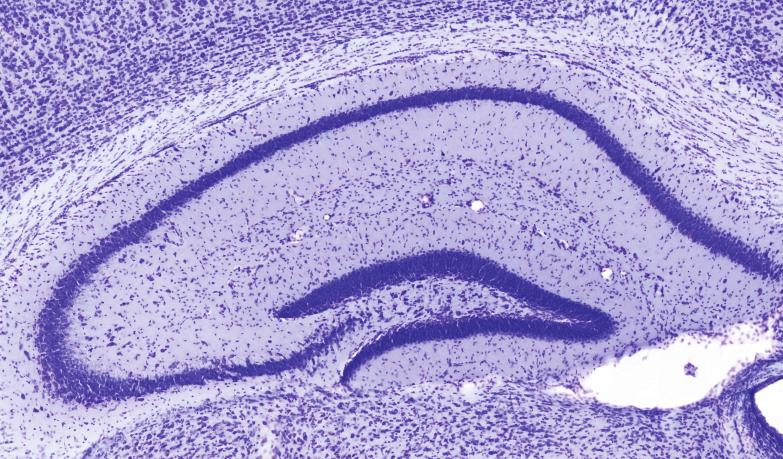 Part II Hippocampus Pyramidal neurons