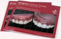 Colour Tone Gingival Colouring Acrylic - the aesthetic advantage Introduction As part of the Schottlander Denture System, Enigma and Pegasus Denture Bases and Repair Acrylic form a range of materials