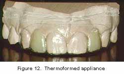 4. After checking the incisal efficiency of the pontic (Figure 11), secure it in place with a quick-cure or light-cured acrylic. Don t use wax.