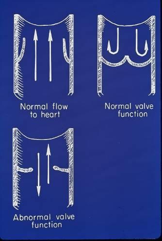Venous Valvular Function Valve leaflets allow unidirectional flow, upward or inward Dilation of vein wall