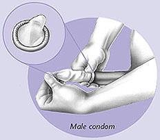 A Warning About Using Spermicides ). How to Use a Condom Using a condom the right way can prevent pregnancy and help protect you and your partner against STDs.