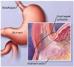Rectum and Anus End of gastrointestinal tract, extending from large intestine Rectum: