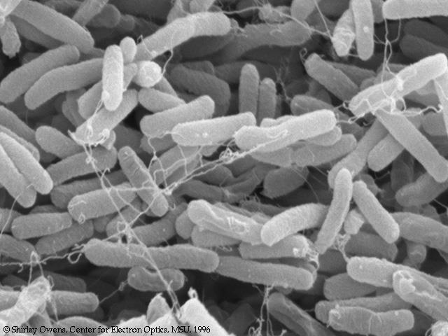 You ve got company! Living in the large intestine is a community of helpful bacteria Escherichia coli: E. coli PEE-YOO!