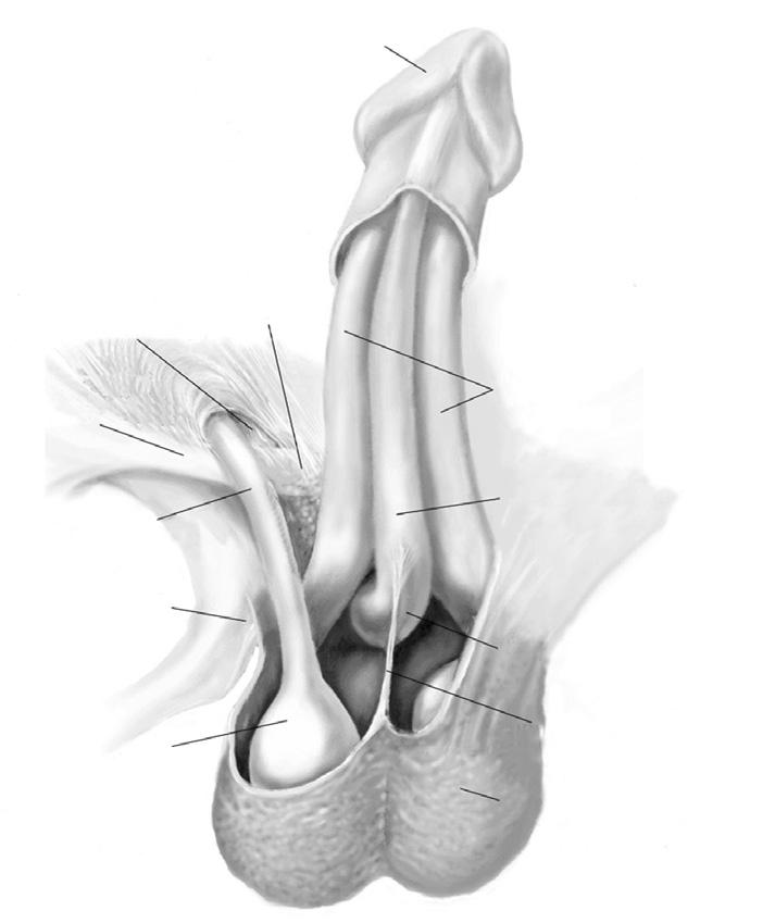 Use finger dissection to develop a pouch beneath the rectus but anterior to the transversalis fascia (cephalad to the inguinal ring).