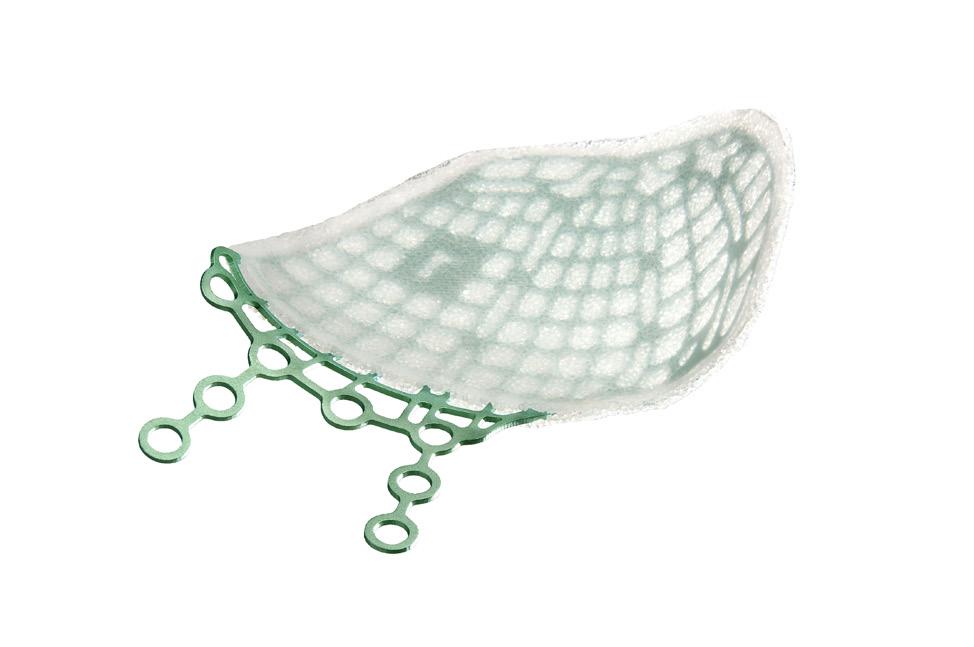 MEDPOR TITAN Combines high-density polyethylene and titanium mesh in a single implant for increased flexibility, shape retention, radiographic visualization and strength 1.