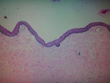 parakeratinised stratified squamous epithelium about 6-8 layers thick with basal