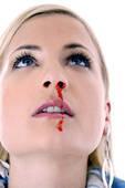 Nose Bleeds Causes drying of mucus membranes, winter months The nose has a hrad bony part and a soft part