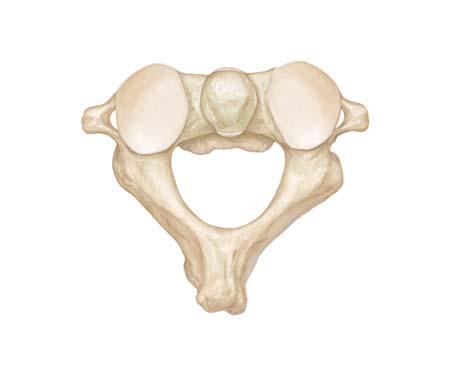C1 ventral ramus Posterior tubercle Posterior arch Inferior articular facet for axis