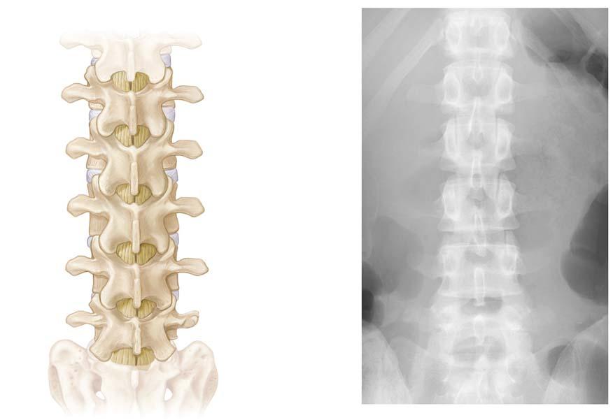Radiograph of lumbar vertebrae, lateral view 2 Inferior articular 2 articular Intervertebral disc es