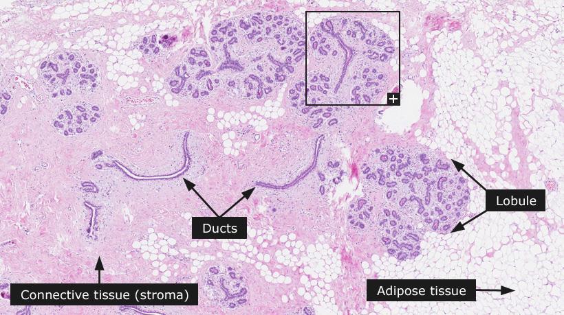 Normal histology of the breast
