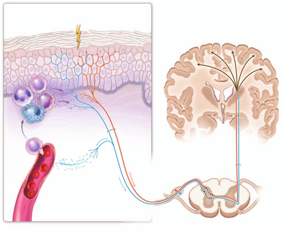 clinical practice Epidermis and Dermal Epidermal Junction Stratum granulosum Itch triggers Histamine-triggered neurons Nonhistaminergic neuron Epidermis T cell Brain Neutrophil Mast cell Eosinophil
