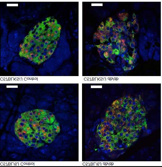 Supplementary Figure S1. Distinct compartmentalization of proinsulin in obese db/db mouse islet ß- cells.