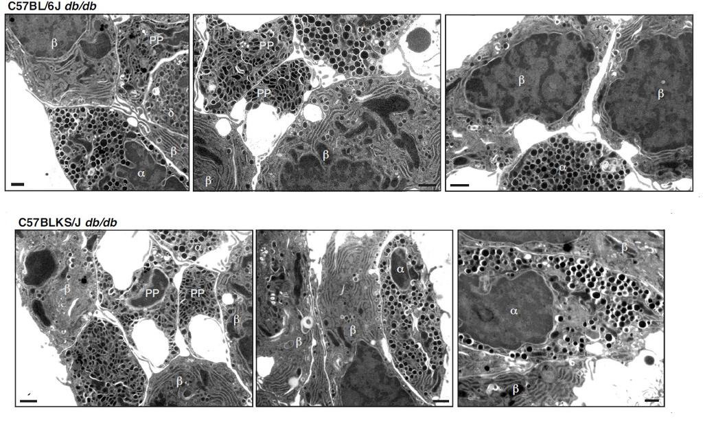 Supplementary Figure S4. Conventional electron microscopy analysis of db/db mouse islets.