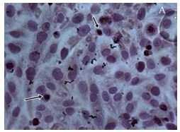 The second result showed on Figure 3. that HeLa cells treated with chloroform extract of P. glauca leaves. The figure showed that prb expression can be detected after treatment.