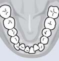perpendicular to Occlusal, Upper and Lower.