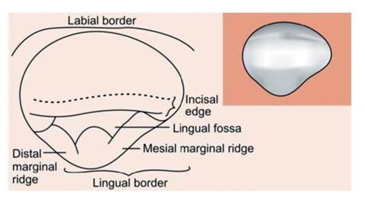 The incisal edge is center over the root. The labial outline is broad & flat. The incisal edge & incisal ridge are well defined.