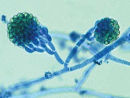 Descriptions of Medical Fungi 105 Gliocladium species have a worldwide distribution and are commonly isolated from a wide range of plant debris and soil. RG-1 organism.