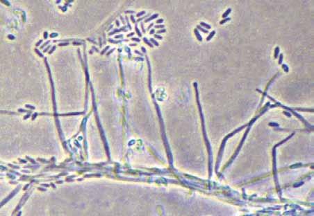 Descriptions of Medical Fungi 1 The genus Acremonium contains many species; most are saprophytic being isolated from dead plant material and soil. Several species including A. recifei and A.