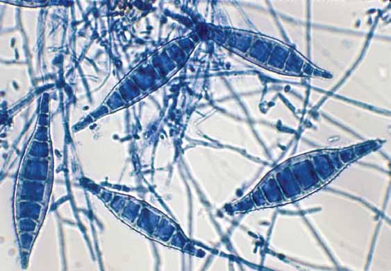 128 Descriptions of Medical Fungi Microsporum canis Bodin 20 µm Microsporum canis typical spindle-shaped macroconidia.