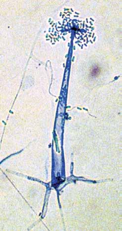 Sporangiophores are typically erect, delicate, 80-250 µm in height, 6-20 µm wide at the base, arising from rhizoids or bulbous swellings on the substrate hyphae and terminating with a compact cluster