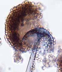 Sporangia are globose, often with a flattened base, greyish black, powdery in appearance, up to 175 µm in diameter and many spored.
