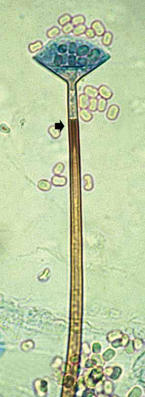sporangiophore, and (b) mature sporangium showing distinct funnelshaped apophyses, columellae, and a conspicuous pigmented subapical