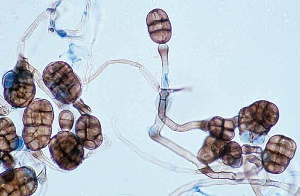 Descriptions of Medical Fungi 189 Most species of Stemphylium are plant pathogens with occasional isolates from soil, they are rarely seen in the clinical laboratory. RG-1 organism.