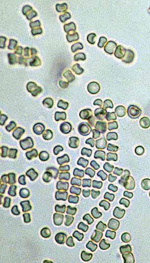 190 Descriptions of Medical Fungi Syncephalastrum racemosum Cohn The genus Syncephalastrum is characterised by the formation of cylindrical merosporangia on a terminal swelling of the sporangiophore.