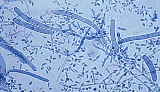 rubrum showing slender clavate microconidia and
