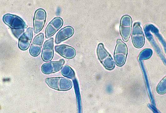 224 Descriptions of Medical Fungi Trichothecium roseum has a worldwide distribution and is often isolated from decaying plant substrates, soil, seeds of corn, and food-stuffs (especially flour