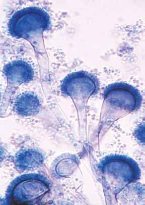 18 Descriptions of Medical Fungi Aspergillus fumigatus Fresenius a b 10 μm b 10 μm b 10 μm