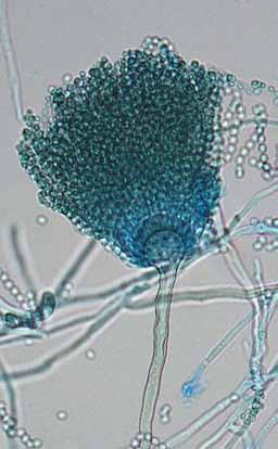 20 Descriptions of Medical Fungi Aspergillus lentulus Balajee & Marr Antifungal Susceptibility: A. lentulus (Australian National data); MIC µg/ml.