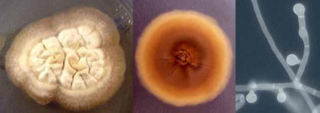 32 Descriptions of Medical Fungi Blastomyces dermatitidis Gilchrist & Stokes At present the genus Blastomyces contains two species, Blastomyces dermatitidis and Blastomyces gilchristi, which are