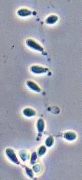 Descriptions of Medical Fungi 51 Chrysosporium Corda Species of Chrysosporium are occasionally isolated from skin and nail scrapings, especially from feet, but because they are common soil