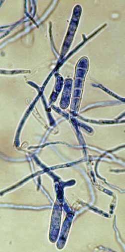 Microscopic morphology shows characteristic smooth, thin-walled macroconidia which are often produced in clusters growing directly from the hyphae.