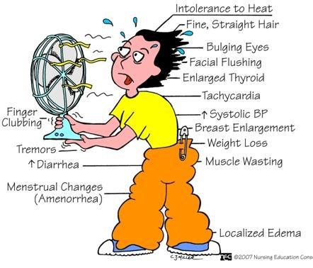 Signs & Symptoms of Hyperthyroidism ผ ป วยบางรายอาจไม ม อาการหร อ อาการแสดงท เป นล กษณะจ าเพาะ ของภาวะธ ยรอยด ฮอร โมนเป นพ ษ โดยเฉพาะในผ ป วยส งอาย