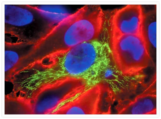HeLa cell (human cancer cell)
