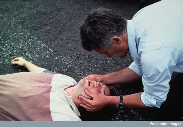 Airway Wellcome Photo Library,