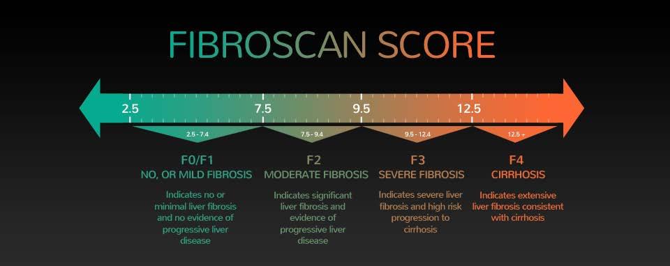 Fibroscan converted to Metavir and