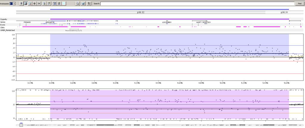 VUS: 2.2 Mb Gain (NCBI37/hg19): arr 1p36.