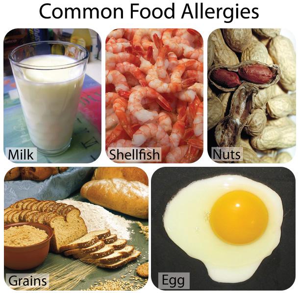 These foods are the most common causes of food allergies. KQED: Hepatitis C: The Silent Epidemic Hepatitis C is a virus that causes cirrhosis of the liver and liver cancer.