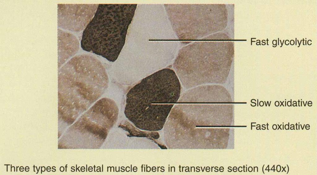 Classification of Muscle Fibers Slow oxidative (slow-twitch) red in color (lots of mitochondria, myoglobin, & blood vessels) prolonged, sustained contractions for maintaining posture Fast