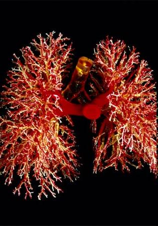 Bronchi fan out like coral in this resin cast that also shows pulmonary arteries and trachea. The bronchi supply air and pulmonary arteries supply blood to the lungs.