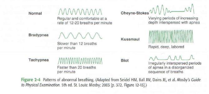 Movements with respiration a. Respiratory Rate b.