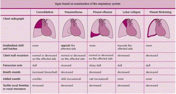 2- Signs in different chest diseases References : 1- OSCE And Clinical skills handbook: Hurley KF, second edition.