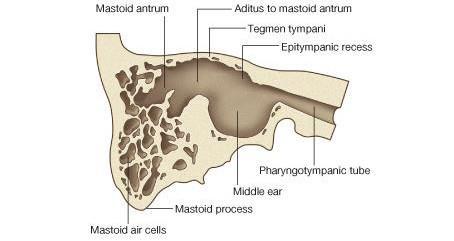 Posterior wall 1-Has in its upper part a large, irregular opening, the Aditus to the mastoid 2-Below this is