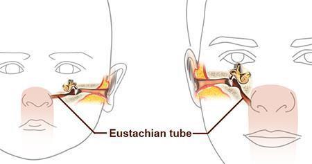 Note: Eustachian tubes (auditory