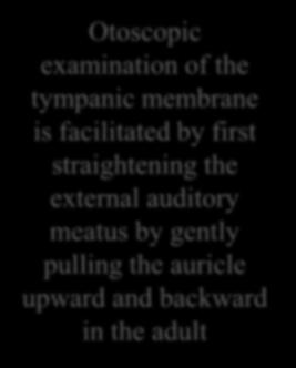 External acoustic meatus Outer third is directed upward and backward Opposite Inner two thirds are directed downward and forward Move the mobile part to make meatus straight